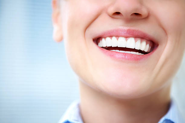 Top-Notch Things To Notice About Teeth Whitening Service