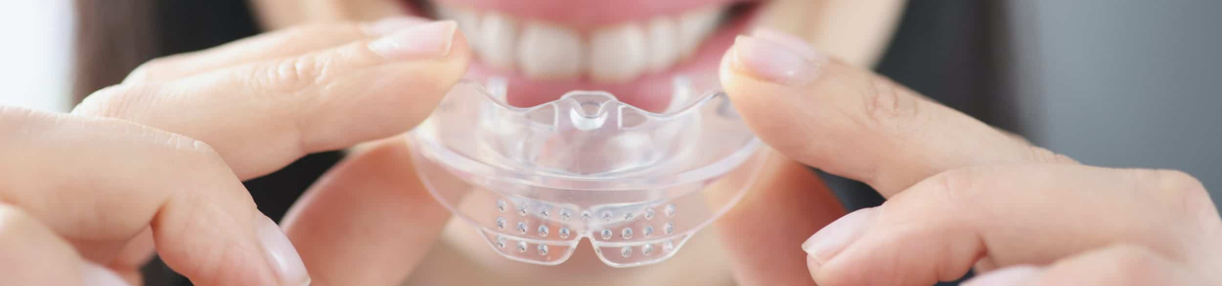 How to Know The Best Oral Appliance For You – SEO Solution Expert US