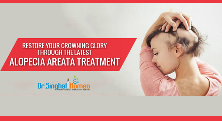 Homeopathic Medicine for Alopecia Areata Treatment