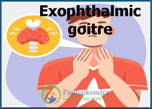 Exophthalmic Goitre | Symptoms, Treatment - Thyroid Gland