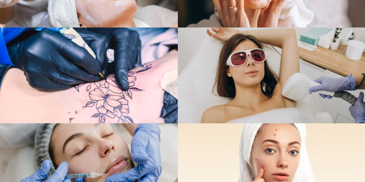 Unveiling the Ultimate Guide to Men's Laser Hair Removal in London