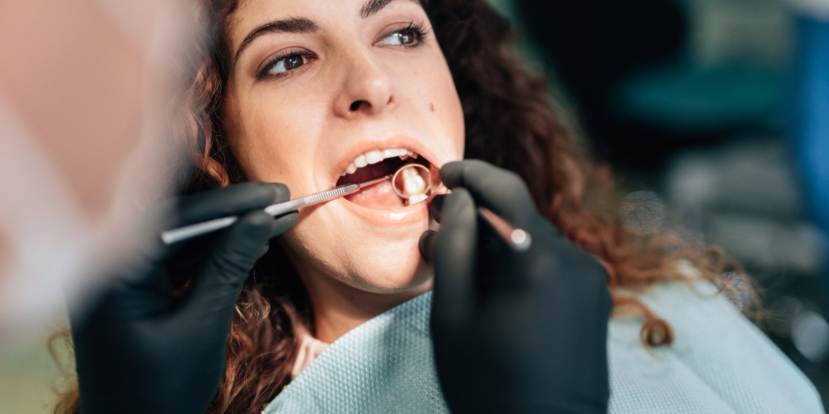 How Dental Cement Enhances the Success of Dental Procedures