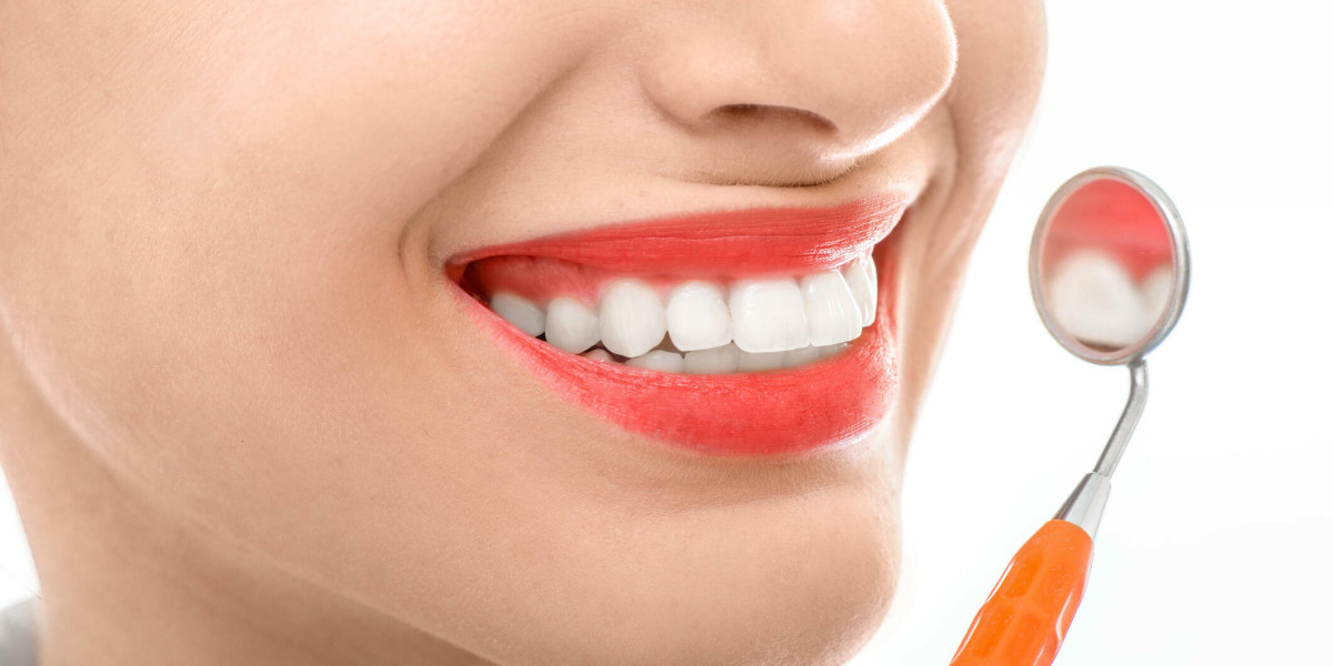 Redefining Smiles: Understanding and Treating Gummy Smiles in Dubai