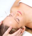 Acupuncturist in Chennai for Best treatment | Acupuncture and Cupping Therapy Near Me