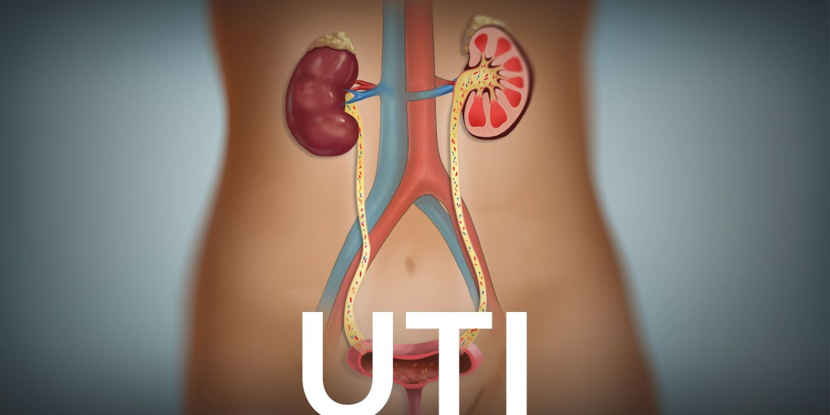 From Diagnosis to Recovery: Navigating UTI Treatment Dyer