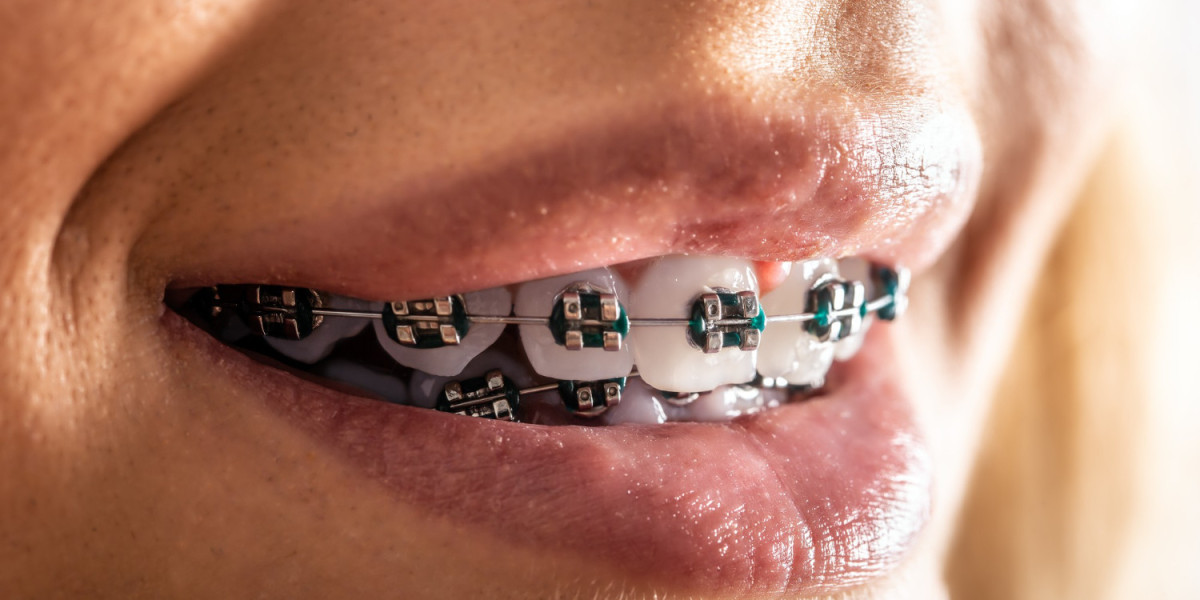 Navigating the Seasons with Braces: A Guide to Participating with Care