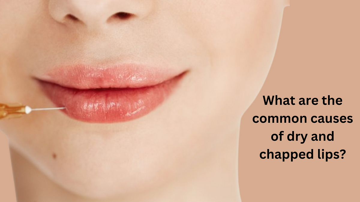 What are the common causes of dry and chapped lips, and how can they be effectively treated? | by clinicgleuhr | Jan, 2024 | Medium