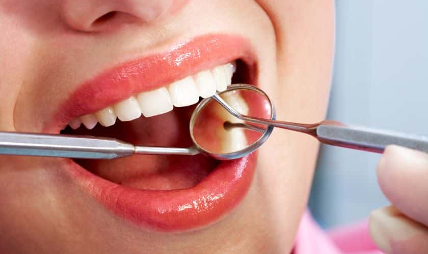 Dental Bonding: A Cost-Effective Solution for Smile Enhancement | TheAmberPost