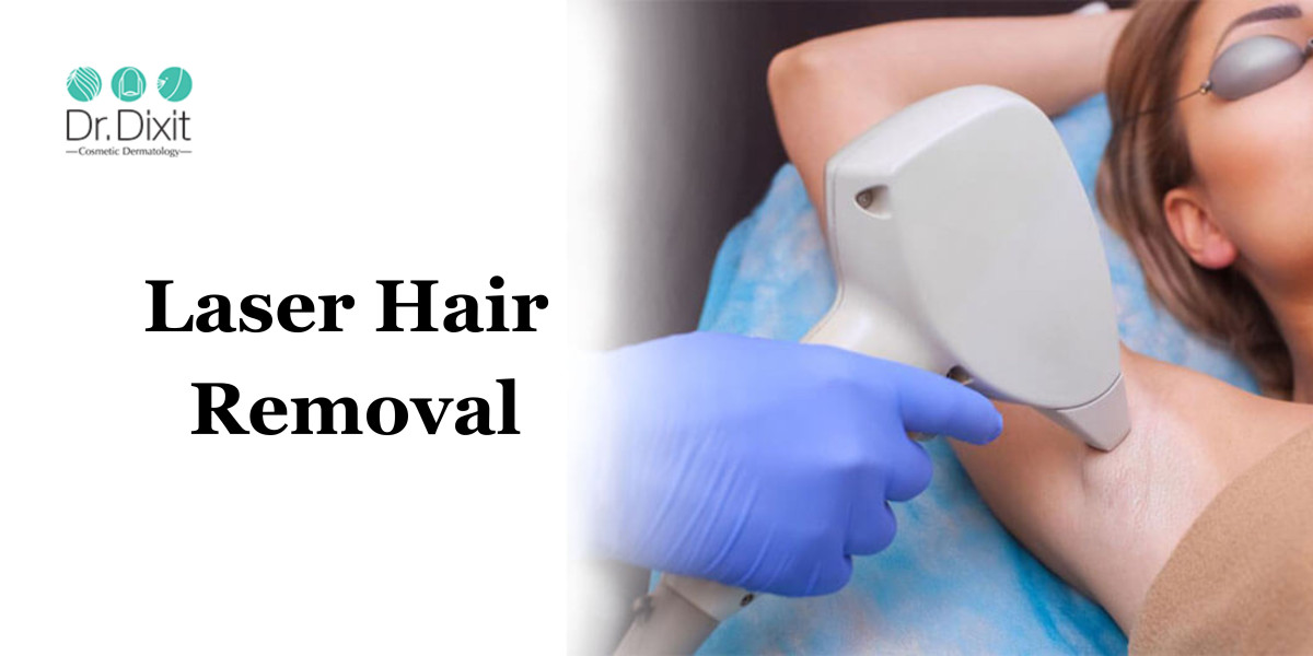Why is Laser Hair Removal the Top Choice for Hair Removal?
