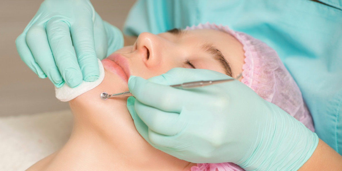 Do facial extractions hurt or damage the skin?