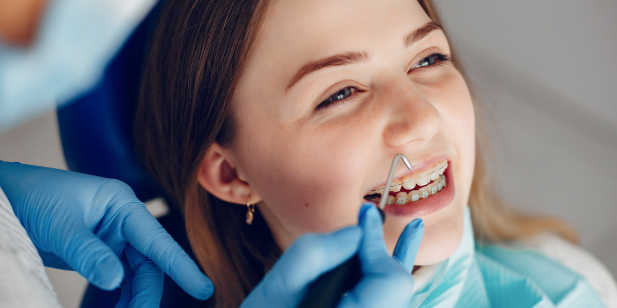 Unlocking the Brighter Smile: Teeth Whitening Service