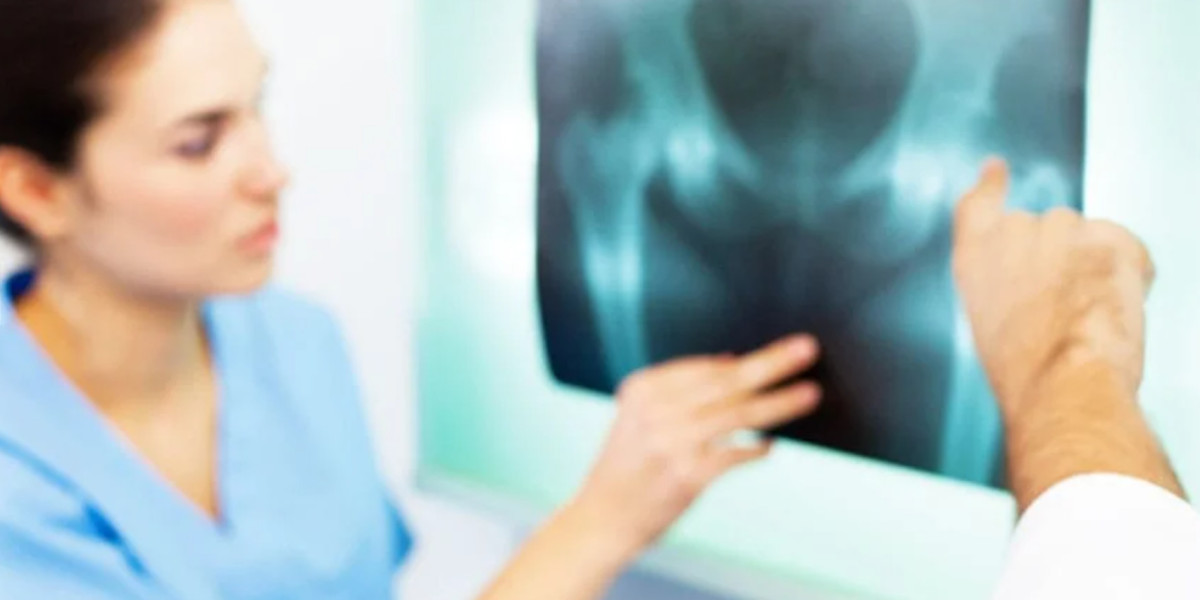Get Convenient X-Ray Services at Home in Mumbai | Lifecare Diagnostics