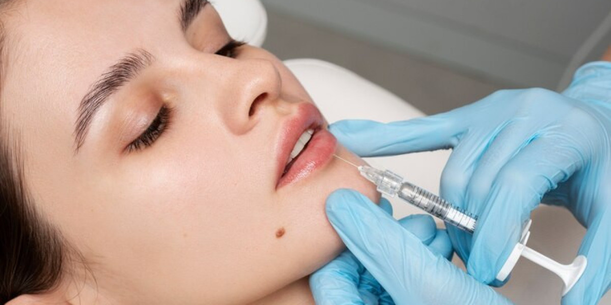 Lip Fillers in Delhi: Enhance Your Beauty with Expert Procedures