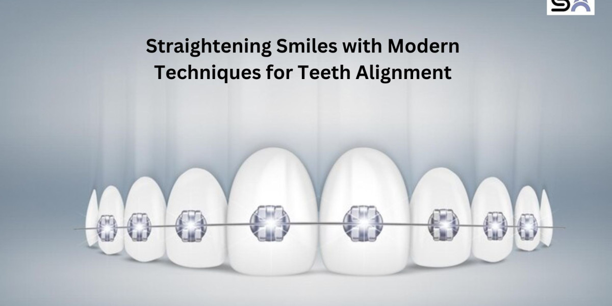 Straightening Smiles with Modern Techniques for Teeth Alignment