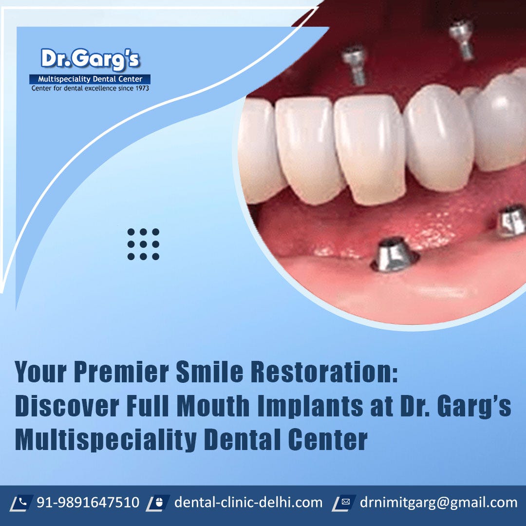 Your Premier Smile Restoration: Discover Full Mouth Implants at Dr. Garg’s Multispeciality Dental Center | by Nimit Garg | Apr, 2024 | Medium
