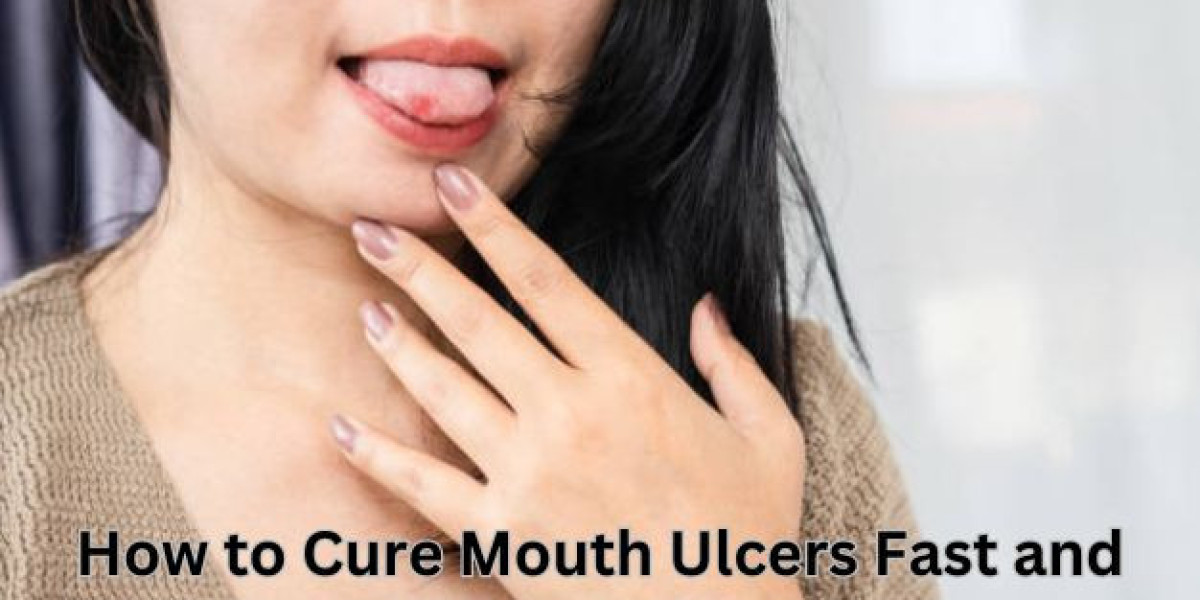Speedy Healing Mouth Ulcers Naturally: Fast and Effective Solutions