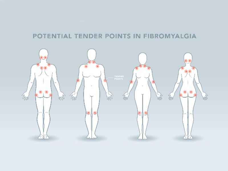 Ayurvedic Treatment For Fibromyalgia - Ayur Healthcare