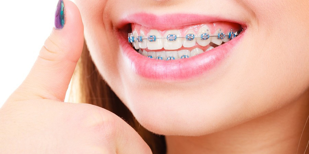 The Global Orthodontic Brackets Market is driven by growing demand for orthodontic treatments
