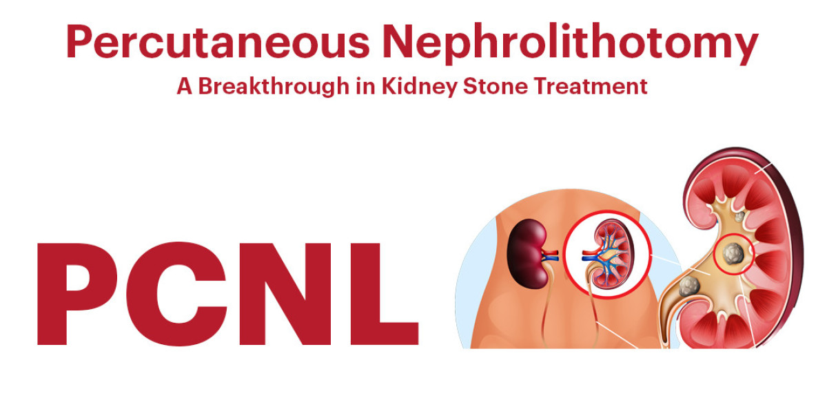 PERCUTANEOUS NEPHROLITHOTOMY (PCNL): A BREAKTHROUGH IN KIDNEY STONE TREATMENT | KIMS Health Trivandrum