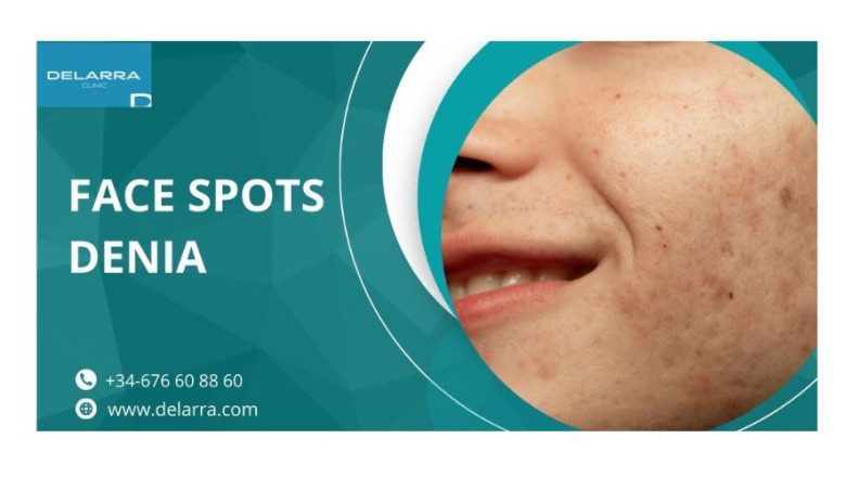 The Ultimate Face Spots Denia Treatment Guide: 5 Proven Methods - Status Thoughts