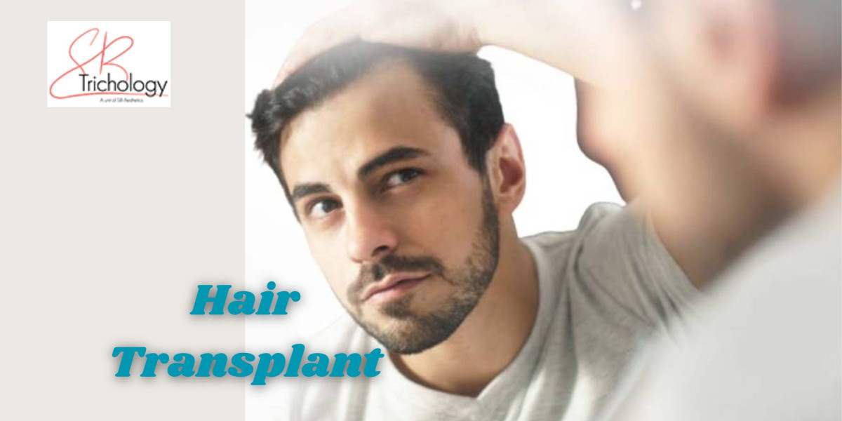 What are the Benefits of Getting Hair Transplant?