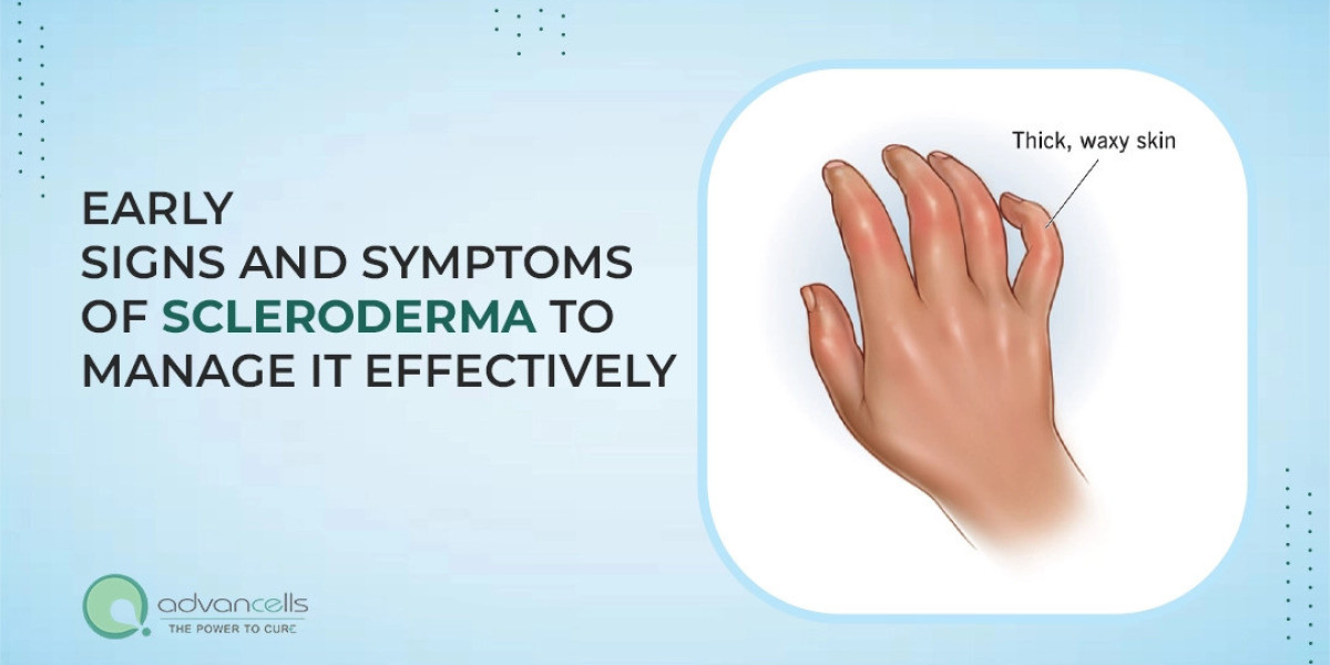 Early signs and symptoms of scleroderma to manage it effectively