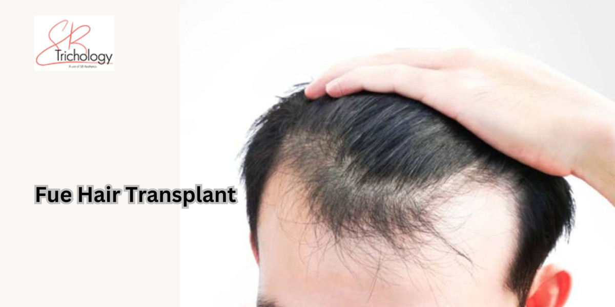 Why must I go for FUE hair transplant surgery?