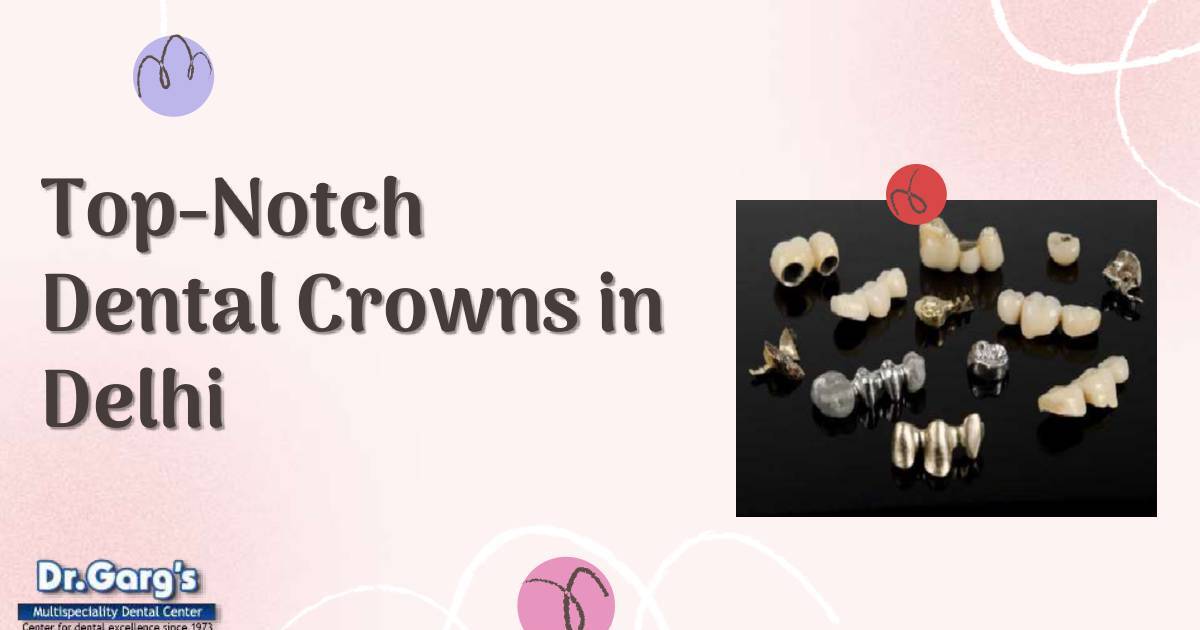 Top-Notch Dental Crowns in Delhi