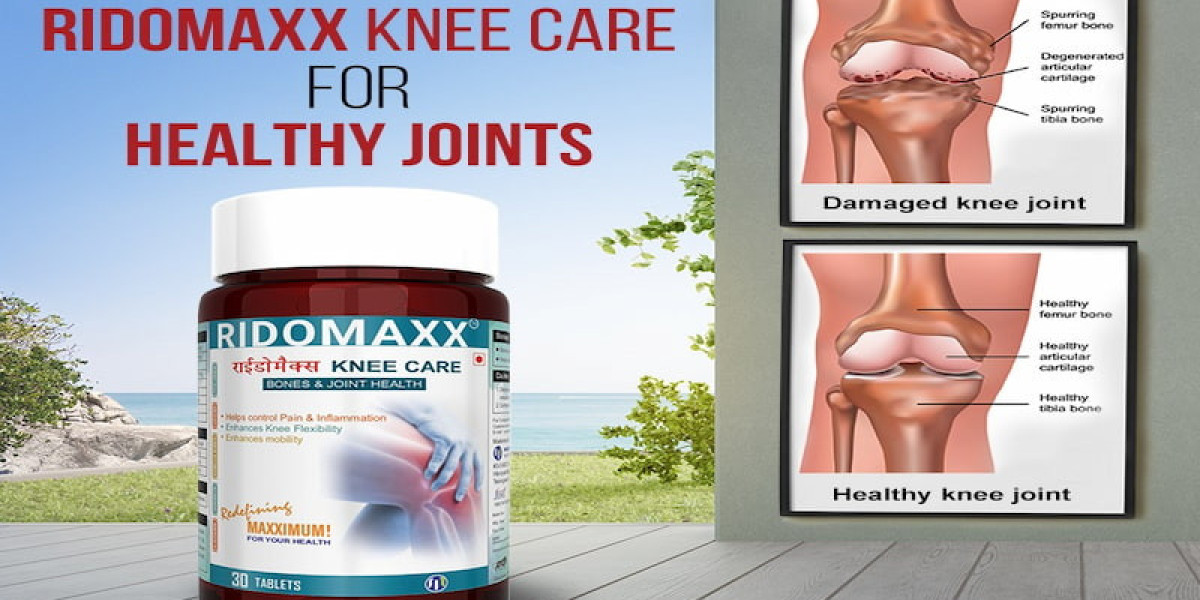Top 8 Tips for Knee Care: Expert Insights