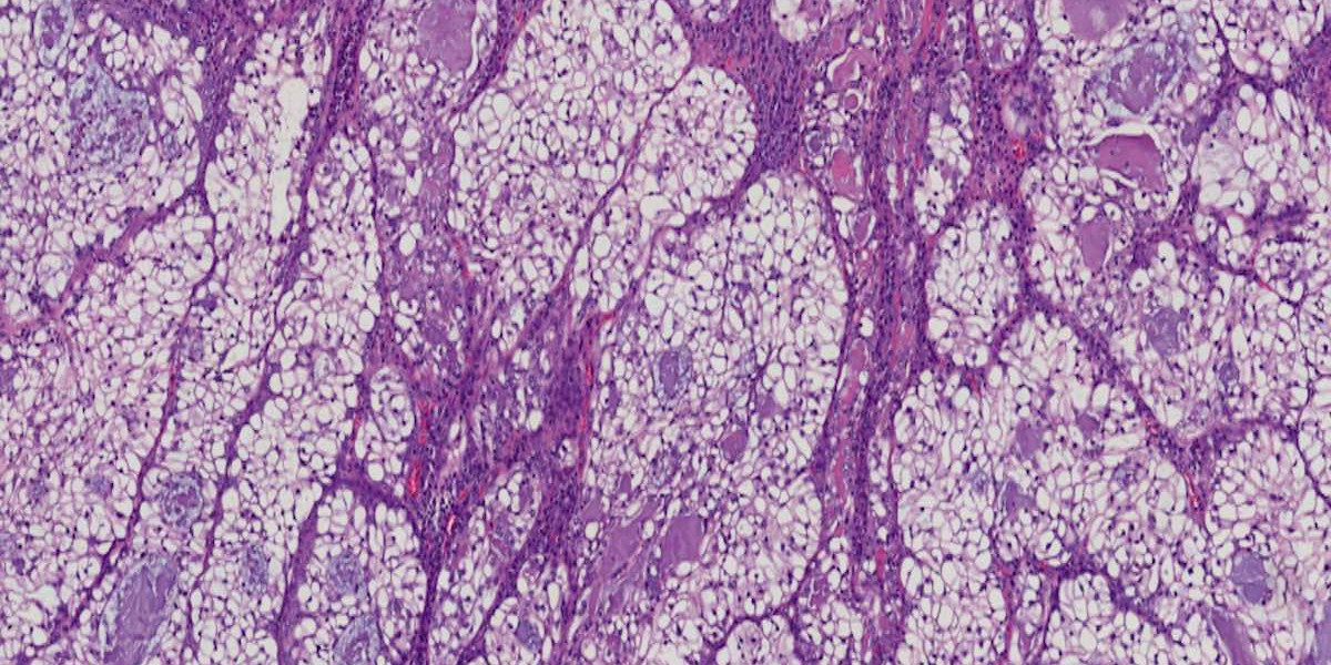 The Crucial Role of Histochemical and Immunohistochemical Staining in Biomedical Research