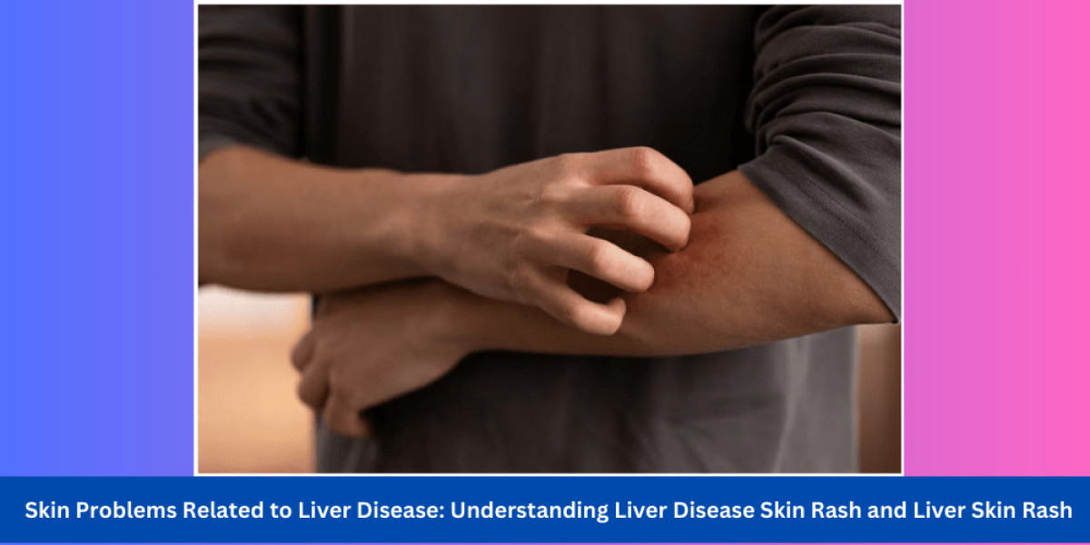 Understanding Skin Problems Related to Liver Disease