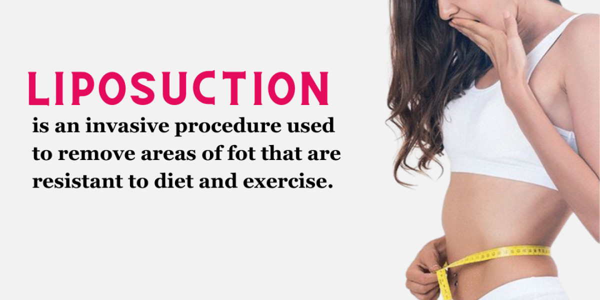 Best Liposuction Surgery in Hyderabad