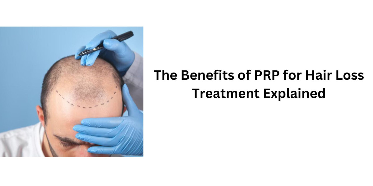The Benefits of PRP for Hair Loss Treatment Explained
