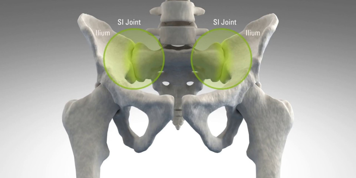 Sacroiliac Joint Fusion : An Overview of the Latest Advancements and Trends in this Specialized Field
