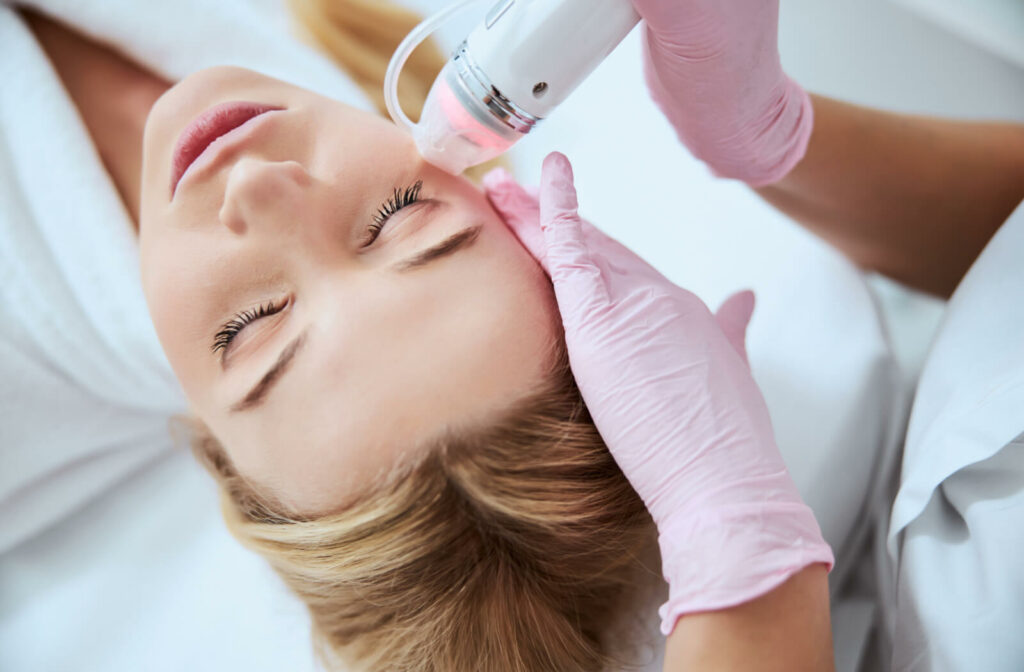 Micro Needling Treatment: Meeting the Demand in Surrey - LOS ANGLES NEWS