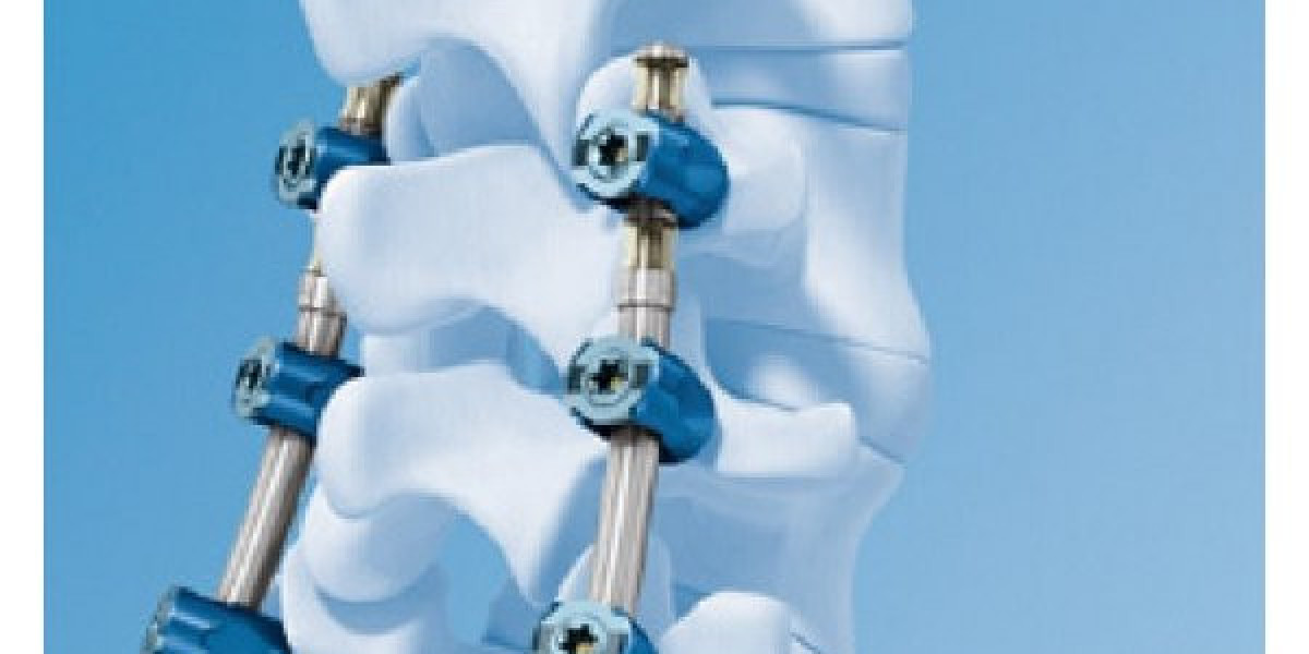 Artificial Discs: A Potential Game-Changer in Spinal Care Exploring the Advantages of an Alternative to Spinal Fusion Su
