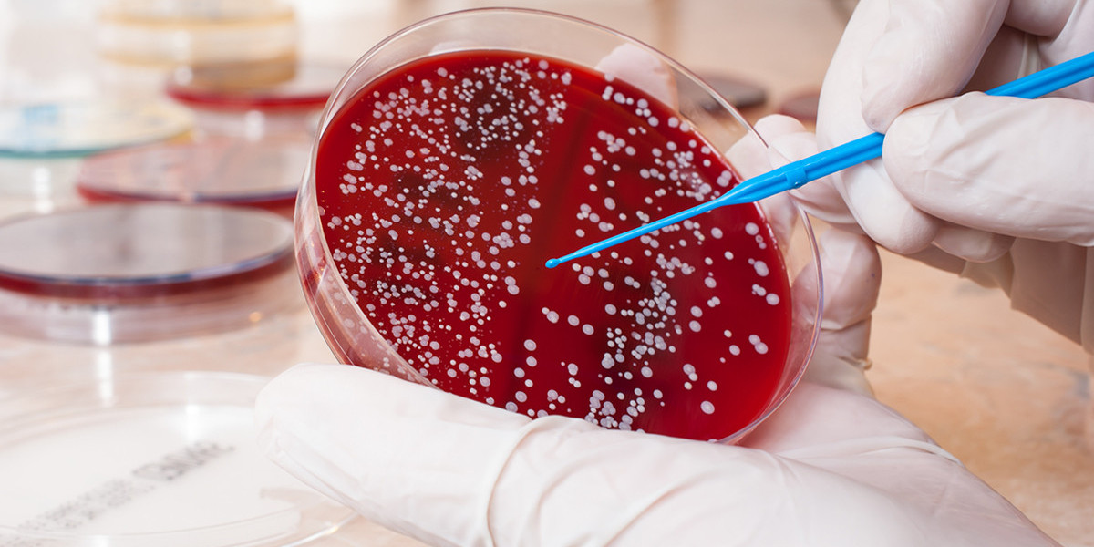 Global Staphylococcus Aureus Testing Industry outlook by 2033