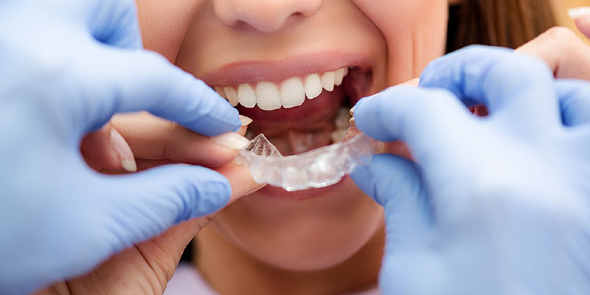 Achieve a Perfect Smile with Cleaner Aligner Braces in Fremantle