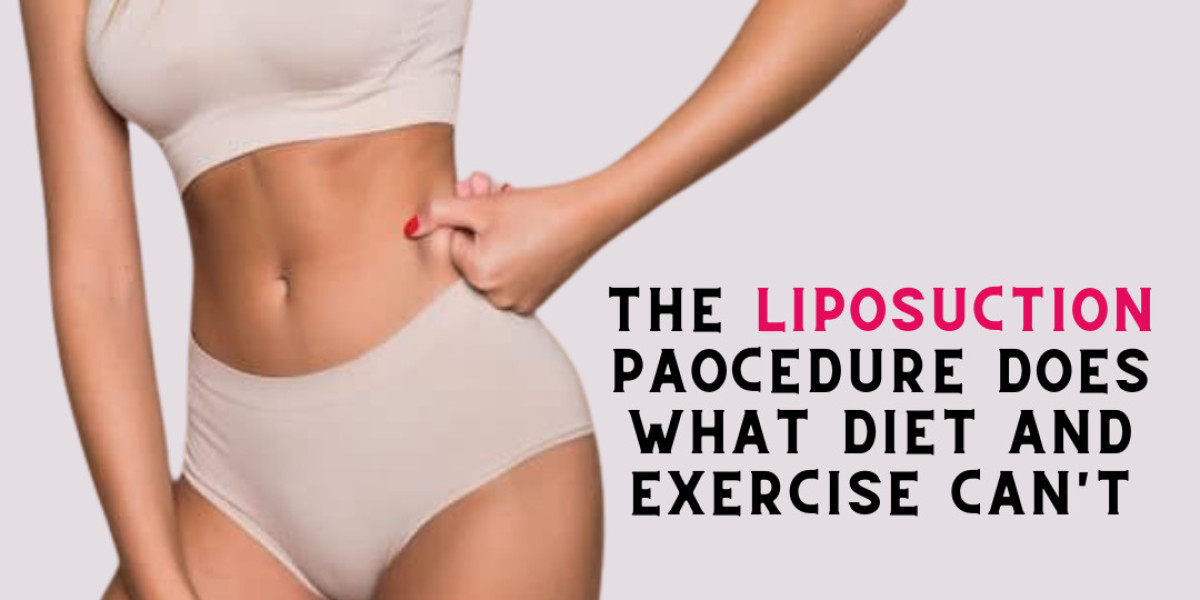 Best Liposuction Surgery in Hyderabad