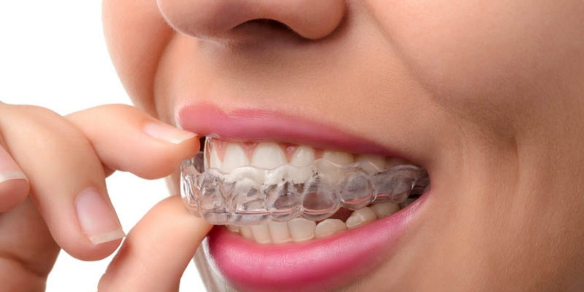 The Benefits of Choosing an Invisalign Dentist in Encino