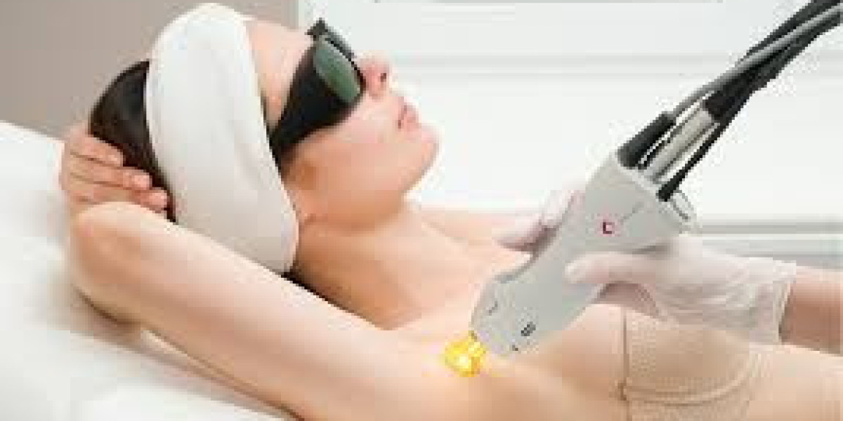 Everything You Need to Know About Candela GentleMax Pro Hair Removal A Comprehensive Guide