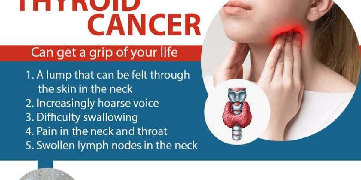 Thyroid Cancer in Treatment in Hyderabad | himayat nagar - Dr. Madhu Devarasetty