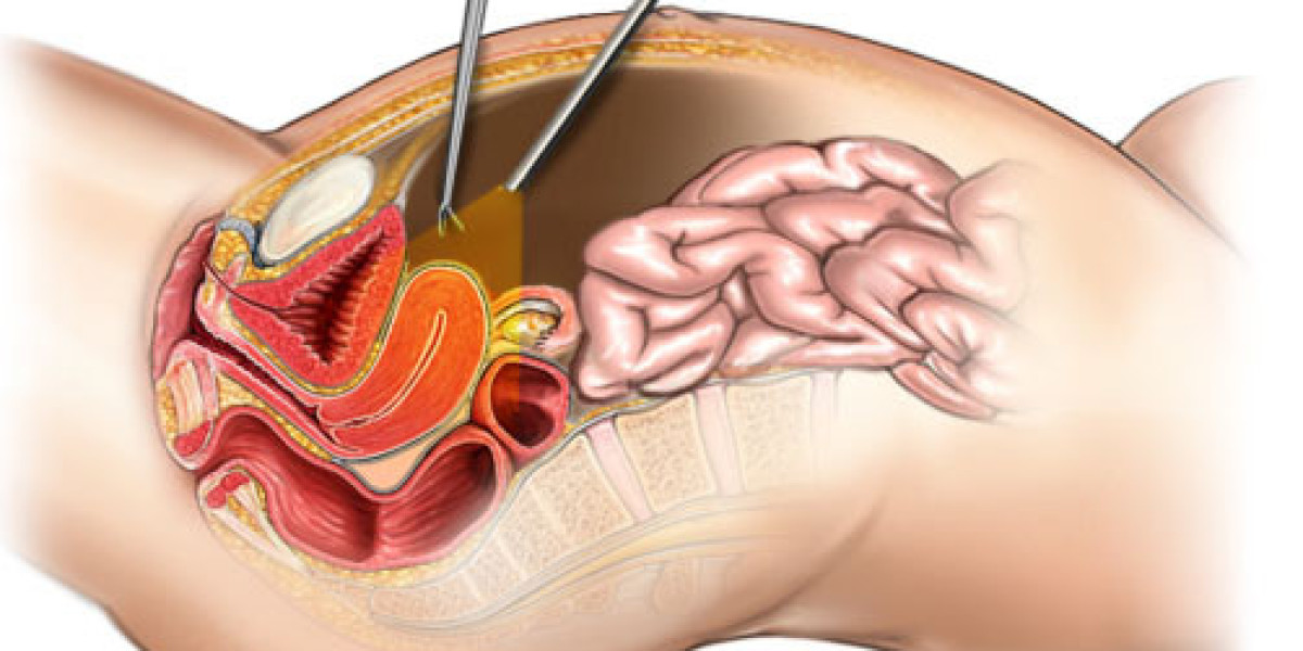 Mumbai Laparoscopic Surgery: Less Invasive, Better Outcomes