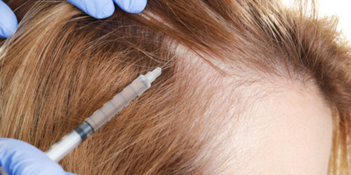 Why Dubai Is the Ultimate Destination for Female Hair Transplants