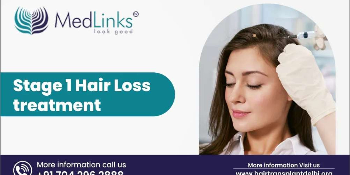 Stage 1 Hair Loss Treatment