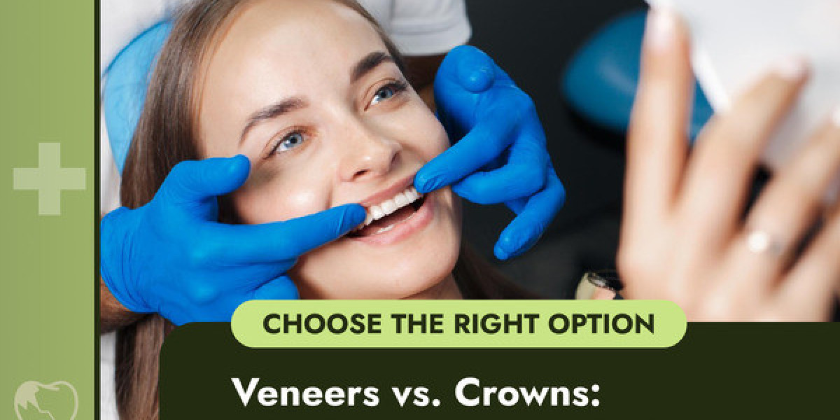 Veneers vs. Crowns: Which Option is Right for You?