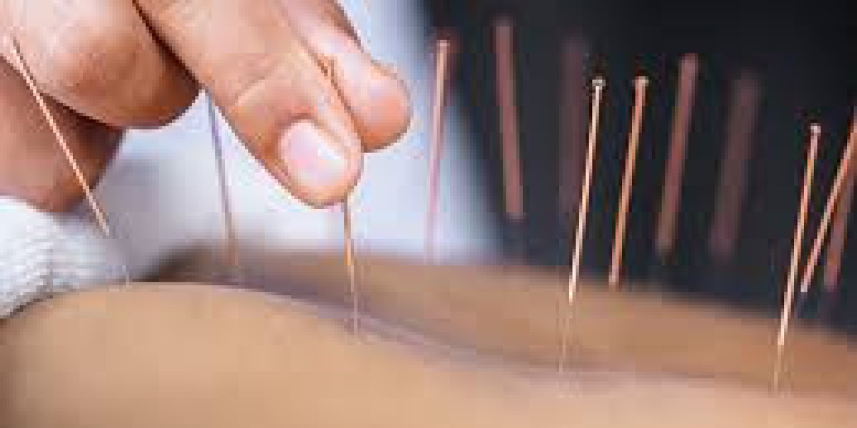 Acupuncture and Biomagnetism: Cross-linking Tradition and Modern healing for Health Experts