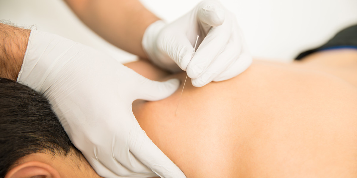 Unlocking the Benefits of Needling Therapy in Las Vegas