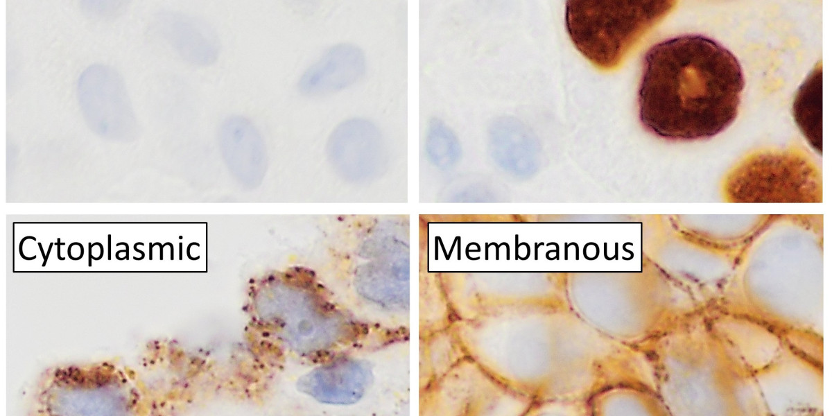 Increasing Cancer Cases Push IHC Market to New Heights