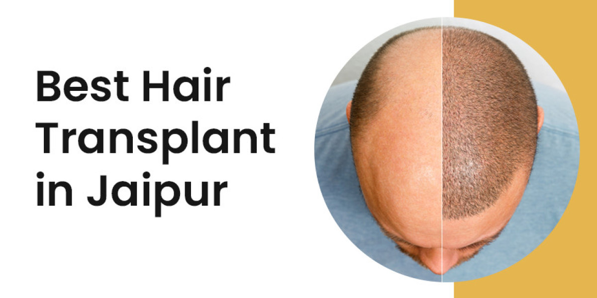 Post-Operative Care for Hair Transplant Surgery: Do’s and Don’ts